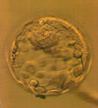 KET - přenos embryí po rozmražení